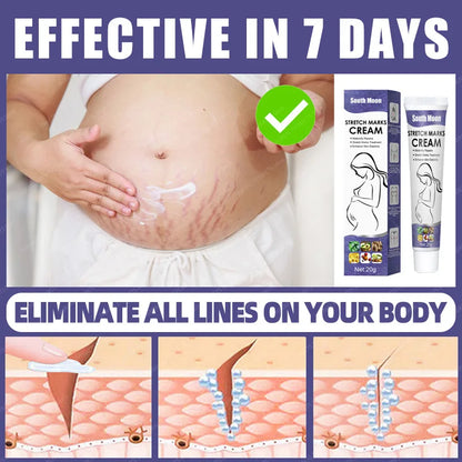 Stretch Mark Repair Cream For Pregnant Women Postpartum Care Firm Light Lines Obesity Lines Growth Lines Repair Cream