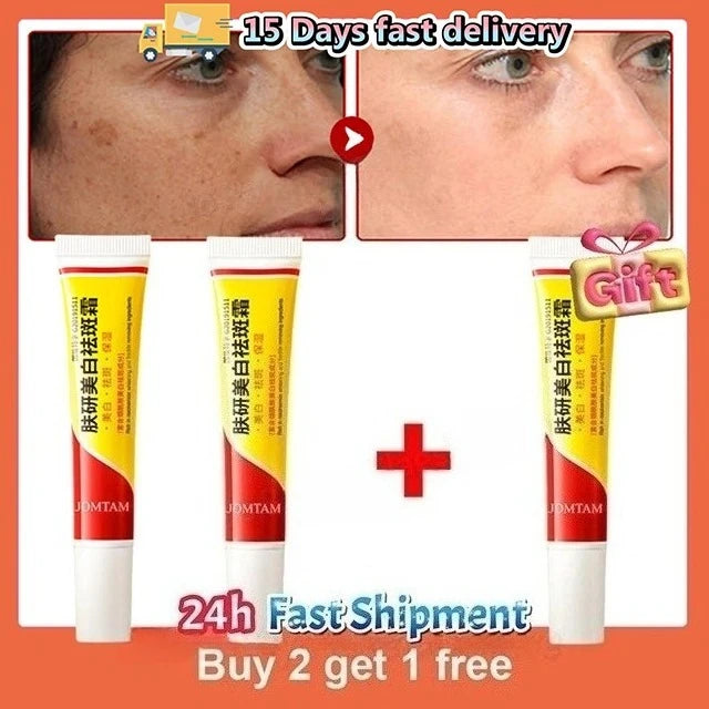 Whitening Freckle Cream Face Brightening Cream Niacinamide Reduce Chloasma Melasma Melanin Fade Fine Lines Lighten Dark Skincare