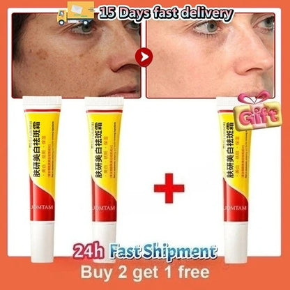 Whitening Freckle Cream Face Brightening Cream Niacinamide Reduce Chloasma Melasma Melanin Fade Fine Lines Lighten Dark Skincare