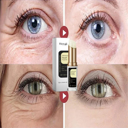Snail Eye Cream Stick Collagen Fade Fine Lines Wrinkle Lightening Dark Circles Firming Eye Bags Puffiness Moisturizing Eye Cream