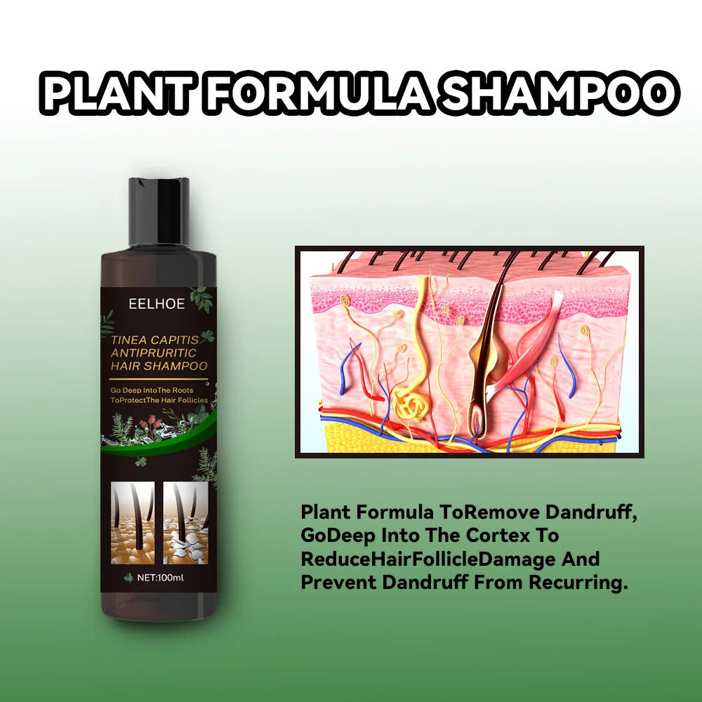 EELHOE Anti It-ching Shampoo Hair Growth Moisturizing Dry Frizzy Repair Damaged Hair Roots Strengthen Cleaning Scalp Treatment