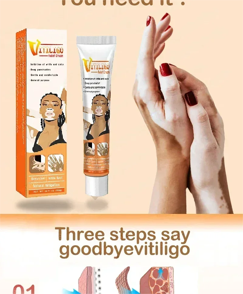 Vitiligo cream, men's and women's skin care essence