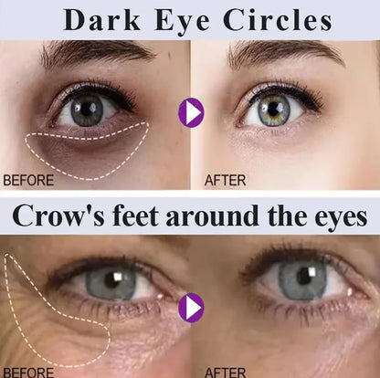 Beauty Salon Line-grade Black Gold Royal Jelly Collagen Light Wrinkle Eye Cream Care Anti Wrinkle Cream Eye Bags Contour Beauty