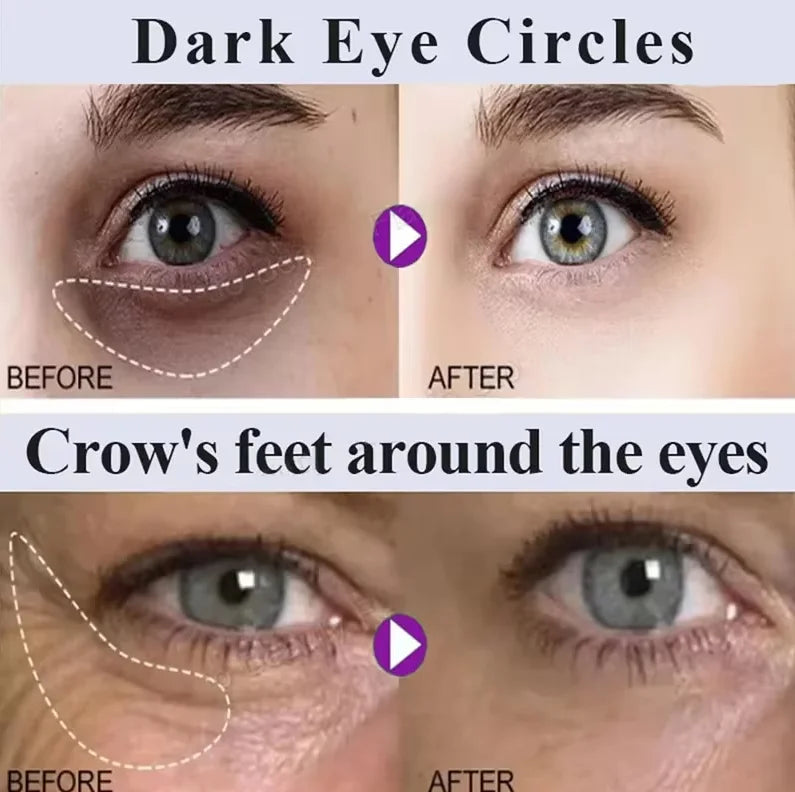 Beauty Salon Line-grade Black Gold Royal Jelly Collagen Light Wrinkle Eye Cream Care Anti Wrinkle Cream Eye Bags Contour Beauty