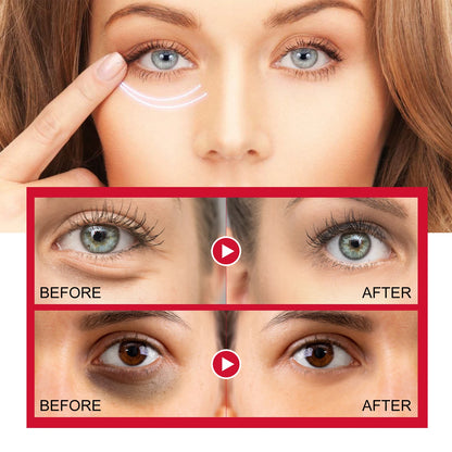 Retinol Eye Cream Stick Lightening Dark Circles Firming Skin Anti-Wrinkle Firming Brightening Eye Repair for Women Eyes Care