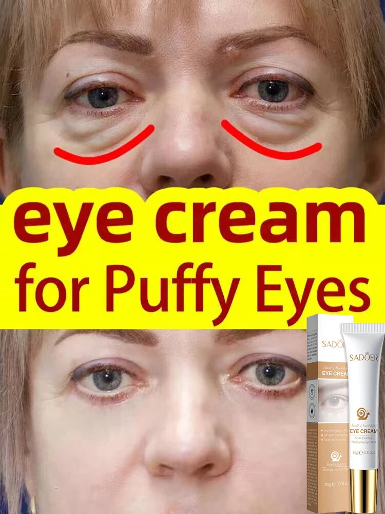 Instant Eye Bag Removal Cream Collagen Removal Wrinkles Lifting Fade Fine Lines Moisturizing Brightening Anti Puffiness Eye Care