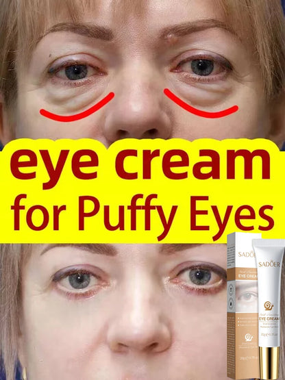 Instant Eye Bag Removal Cream Collagen Removal Wrinkles Lifting Fade Fine Lines Moisturizing Brightening Anti Puffiness Eye Care
