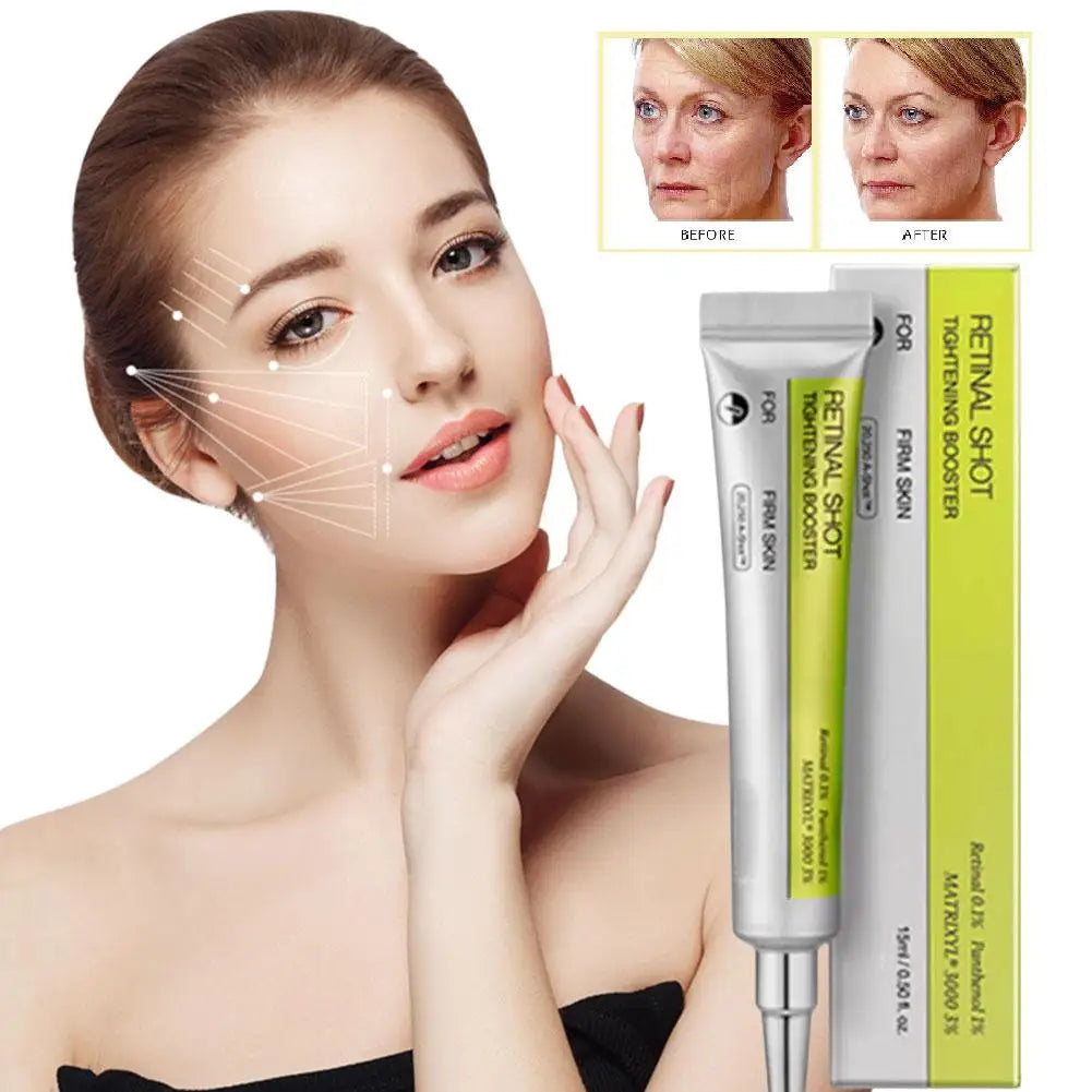 Retinol Shot Eye Essence Serum Long Lasting Moisturizing Dark Circles Wrinkles Smoothing Gentle Non Irritating Eye Skin Care