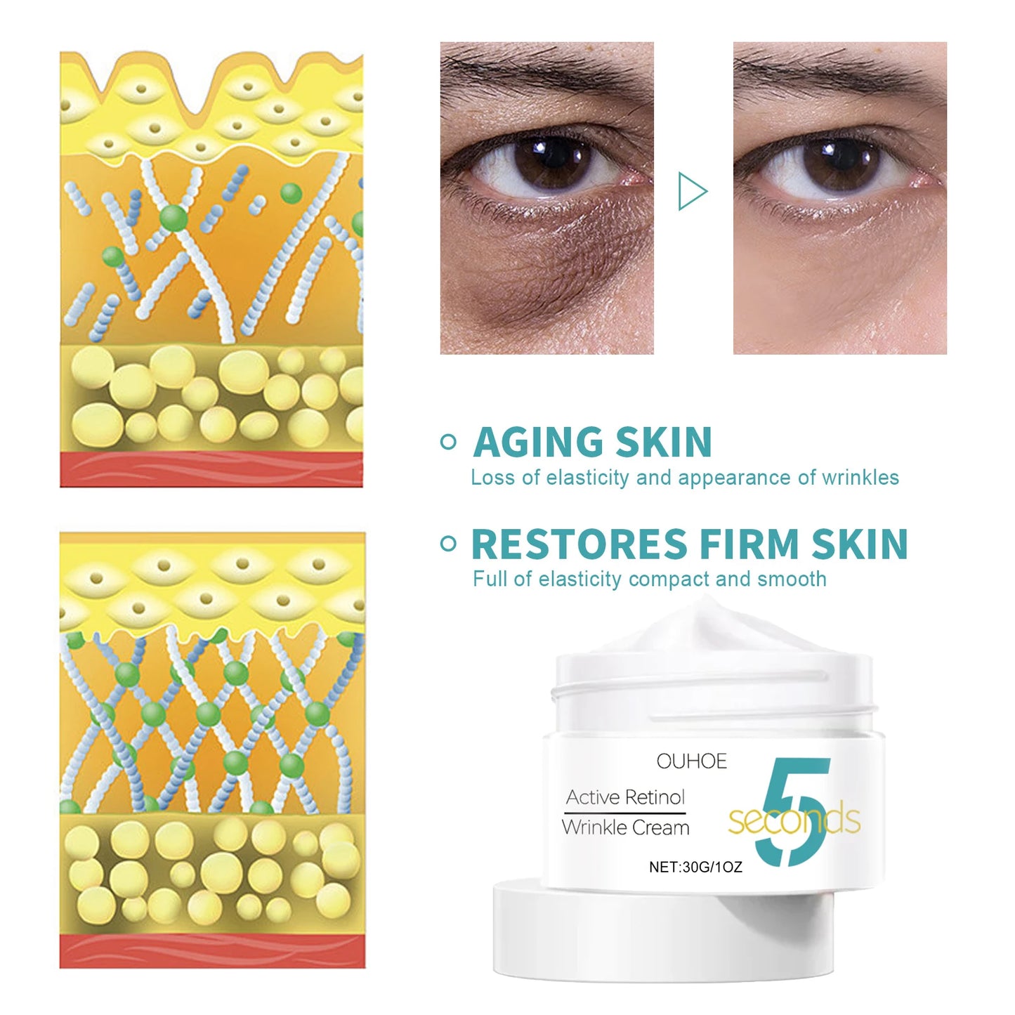 5 Seconds Instant Remove Wrinkles Cream Retinol Anti Aging Firming Moisturizing Tightens Improves Edema Facial Skincare Cream