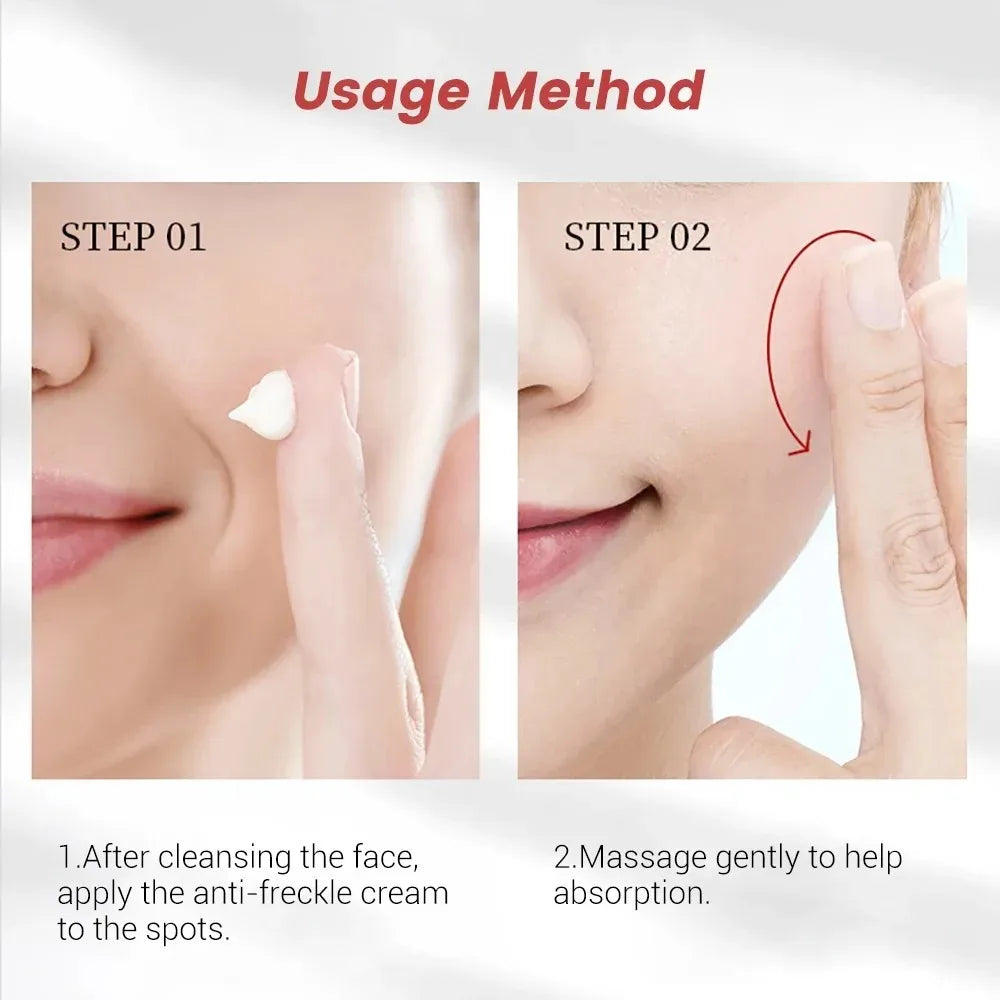 1/3/5pcs Whitening Freckle Cream Niacinamide Remove Dark Spot Cream Anti Freckle and Aging Cream Fade Pigmentation Melasma Skin