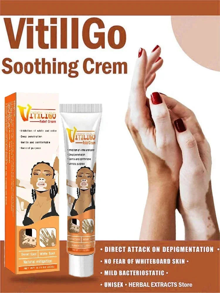 Vitiligo cream, men's and women's skin care essence
