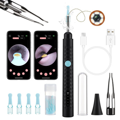 Smart Visual Ear Camera Set HD 1080P with WiFi Ear Pick Endoscope Ear Cleaner with Tweezers Ear Wax Removal Tool Ear Spoon Case