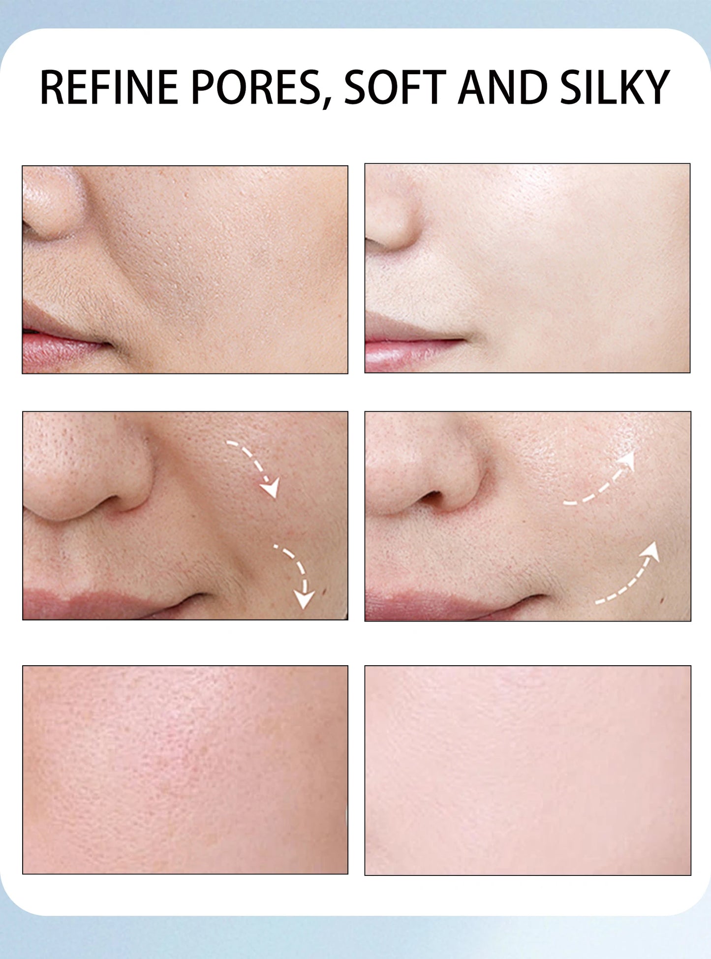 Niacinamide face cream, minimizes pores, moisturizes, suitable for oily skin, effectively hydrates.