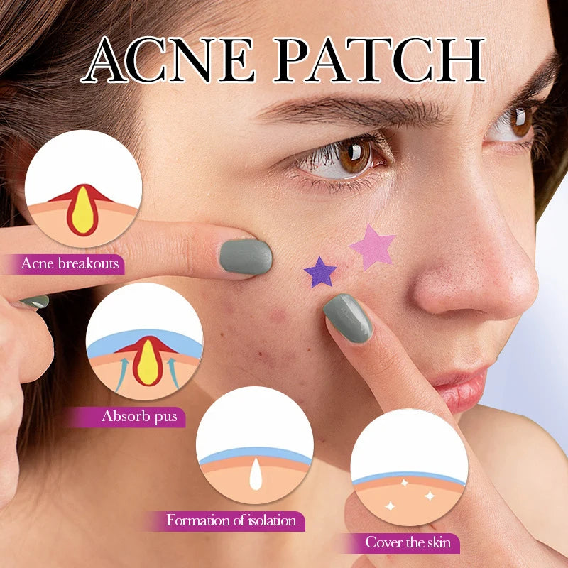 1Box Acne Patch Fade Makeup Tool Acne Removal Stickers Four-color Concealer 32 Patches Star Style With Mirror Repair Invisible