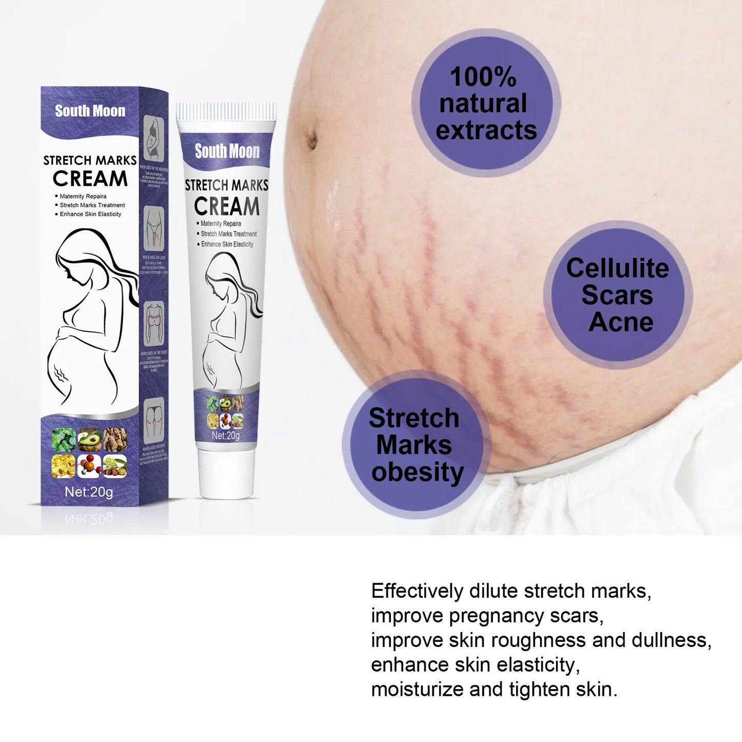 Pregnancy Stretch Removal Cream Fade Postpartum Obesity Lines Eliminate Body Belly Stretch Marks Improve Elasticity Firming Skin