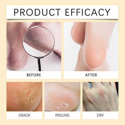 Honey Hand Foot Moisturizing Cream Nourishing Softens Cuticles Anti Dry Cracked Smooth Moisturizing Hand Foot Care Cream