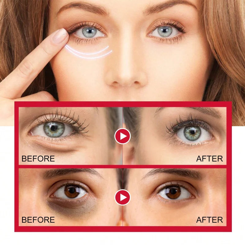 Women's Retinol Eye Cream Series Serum Lightening Dark Circles Lifting And Firming Skin Anti Aging Eye Repair Seoul 1988 Product