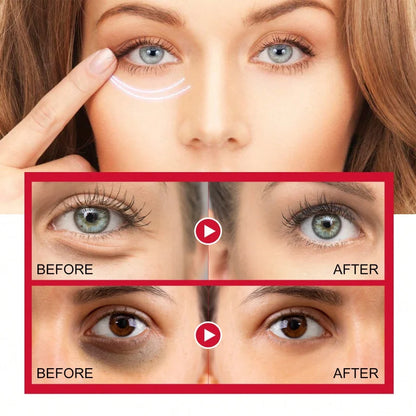 Women's Retinol Eye Cream Series Serum Lightening Dark Circles Lifting And Firming Skin Anti Aging Eye Repair Seoul 1988 Product