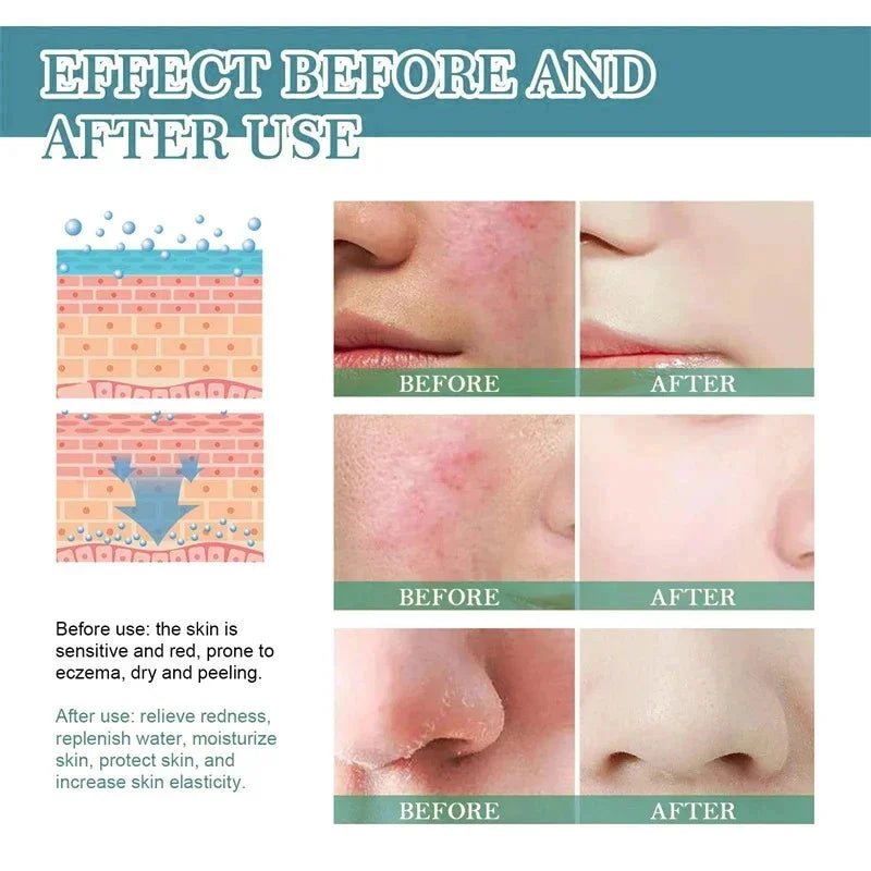 Repair Facial Redness Cream Instant Spider Vein Remove Sensitive Skin Sooth Anti Redness Rosacea Treat Lotion Korean Cosmetics