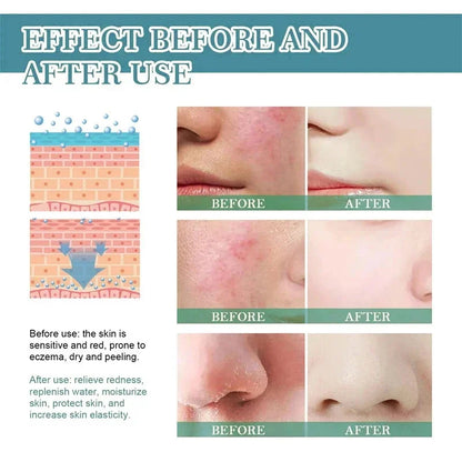 Repair Facial Redness Cream Instant Spider Vein Remove Sensitive Skin Sooth Anti Redness Rosacea Treat Lotion Korean Cosmetics