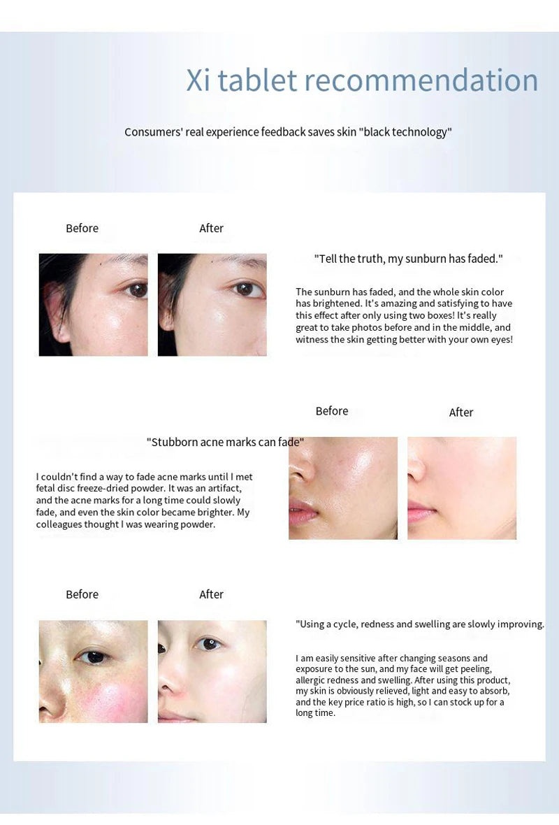 Placent Peptide Ampoule Hyaluronic acid Serum For Face Dr.Pen  Freeze-dried Powder Repair Moisturizing Skin Care Korean