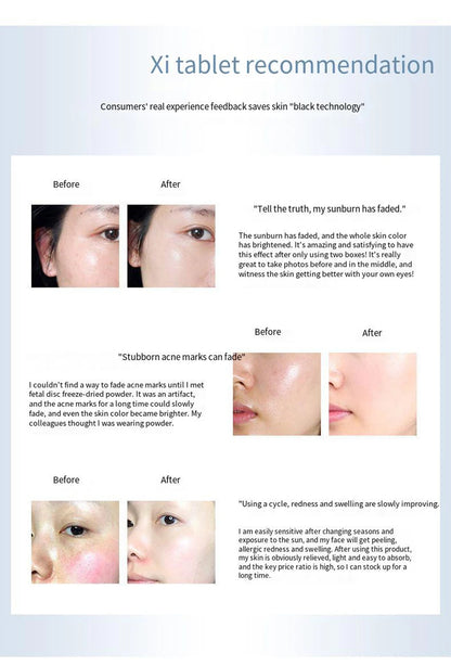 Placent Peptide Ampoule Hyaluronic acid Serum For Face Dr.Pen  Freeze-dried Powder Repair Moisturizing Skin Care Korean