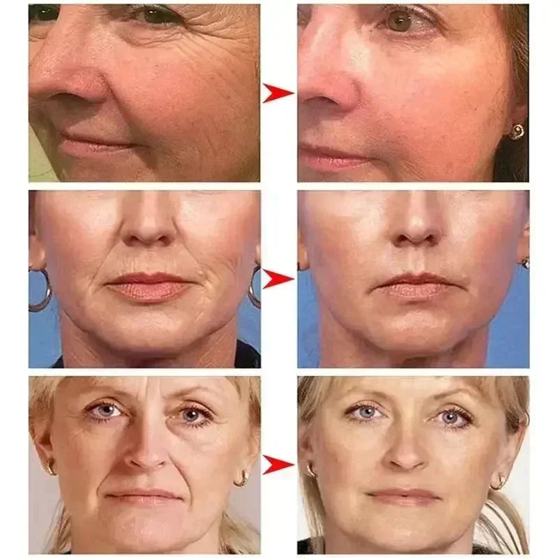Retinol Anti-Wrinkle Cream Repair Instant Wrinkle Brightening Repair Dispelling Wrinkles Firming Lifting Lightweight Skincare