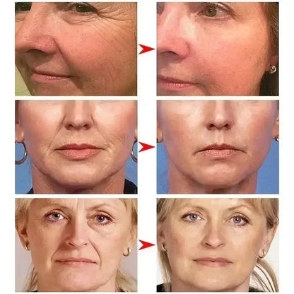 Retinol Anti-Wrinkle Cream Repair Instant Wrinkle Brightening Repair Dispelling Wrinkles Firming Lifting Lightweight Skincare
