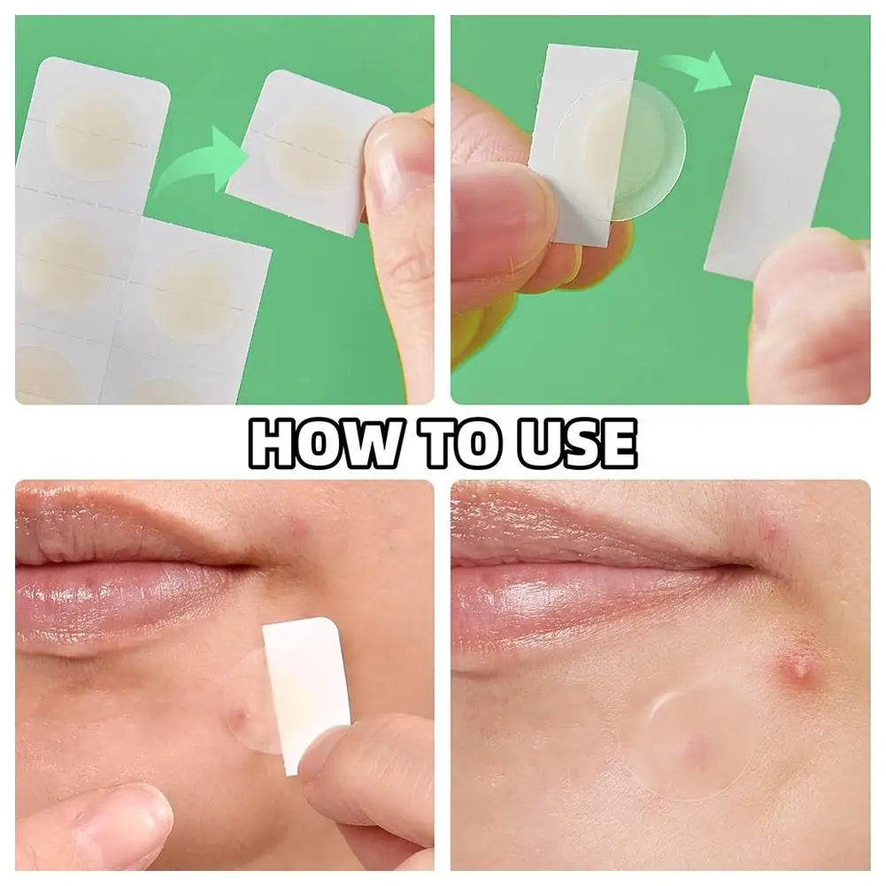 24PCS Microneedle Acne Patch Painlessly Penetrate Acne Patches Blemishes Pimples Covering Patch Daily Unisex Skincare Ultra-fine