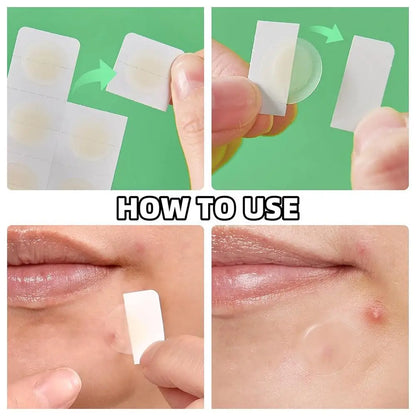 24PCS Microneedle Acne Patch Painlessly Penetrate Acne Patches Blemishes Pimples Covering Patch Daily Unisex Skincare Ultra-fine