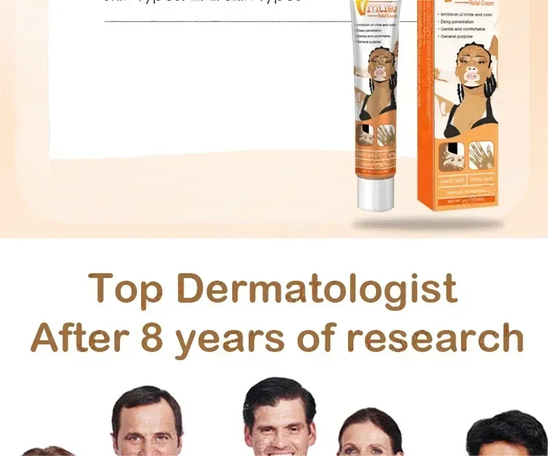 Vitiligo cream, men's and women's skin care essence