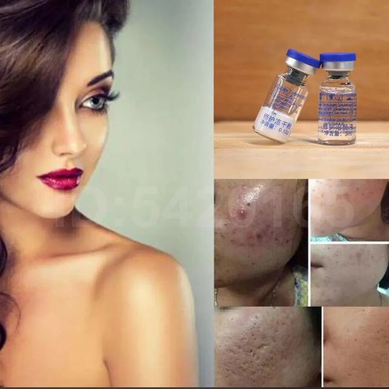 oligopeptide Freeze-dried Powder Essence Repair Facial Hydrating Nourishing Pore Shrinking Skin Rejuvenate Skin Care