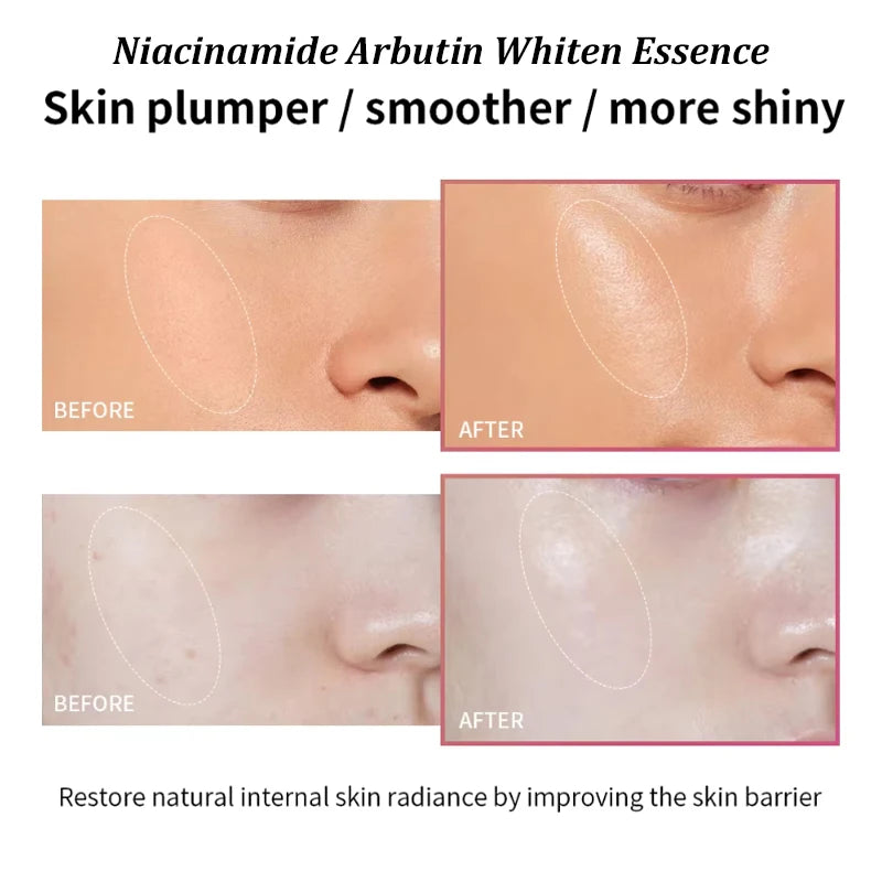 Niacinamide Whiten Serum Arbutin Facial Serum Glass Clarifying Dull Skin Moisturizing Multi-Effect Brightening Korean Skin Care