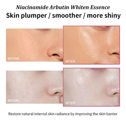 Niacinamide Whiten Serum Arbutin Facial Serum Glass Clarifying Dull Skin Moisturizing Multi-Effect Brightening Korean Skin Care