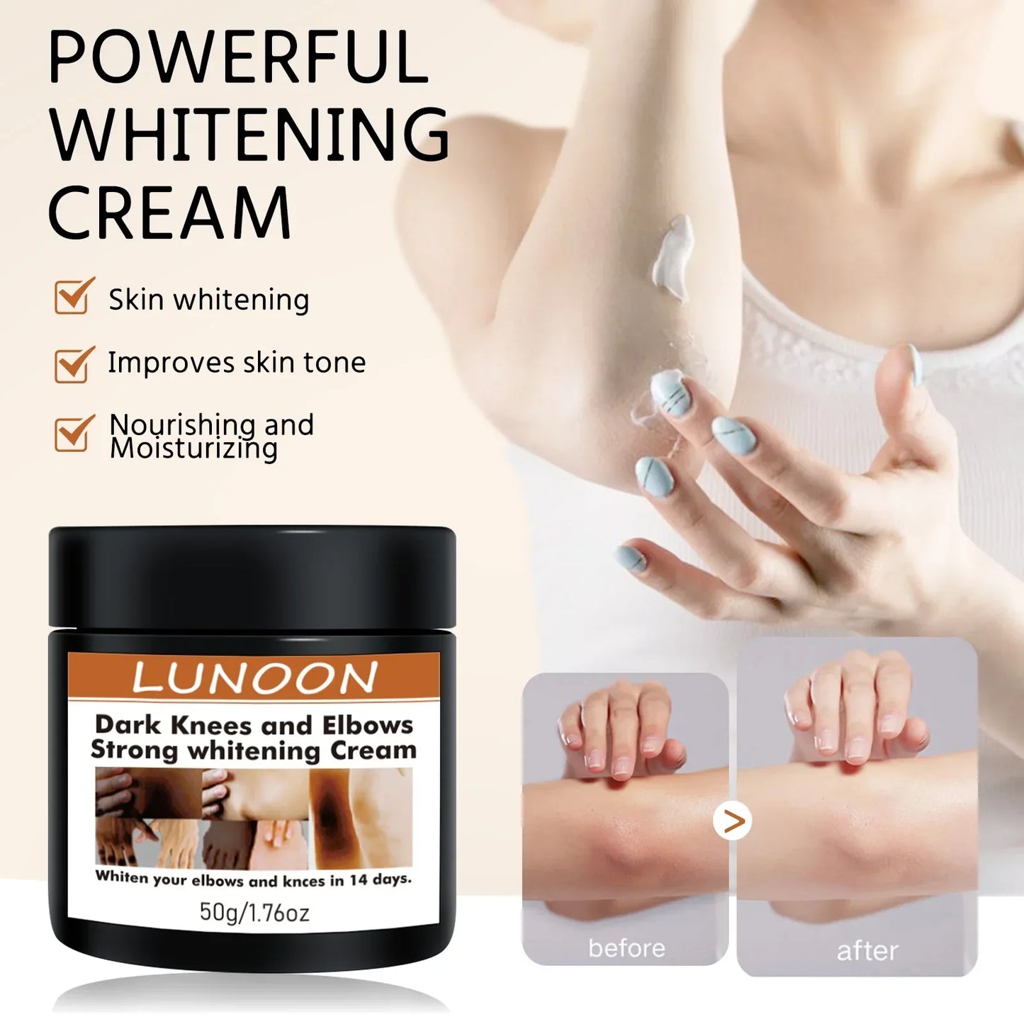 Dark Knuckle Wh-itening Cream Brighten Moisturizing Remover Pigmentation Brightening Knees Skin Care Bleaching Cream