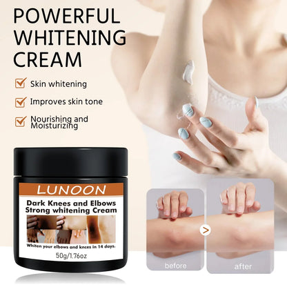 Dark Knuckle Wh-itening Cream Brighten Moisturizing Remover Pigmentation Brightening Knees Skin Care Bleaching Cream