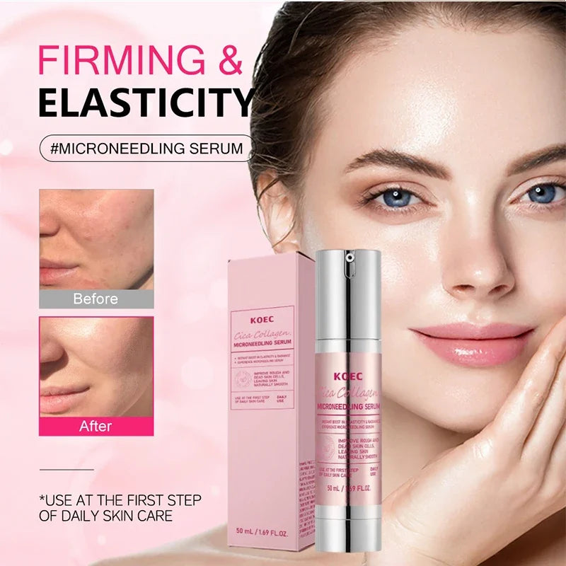 Korean Centella Asiatica Extract Soothes Moisturize Soft Firm Brighten Repair Skin Facial Collagen Microneedle Essence Lotion