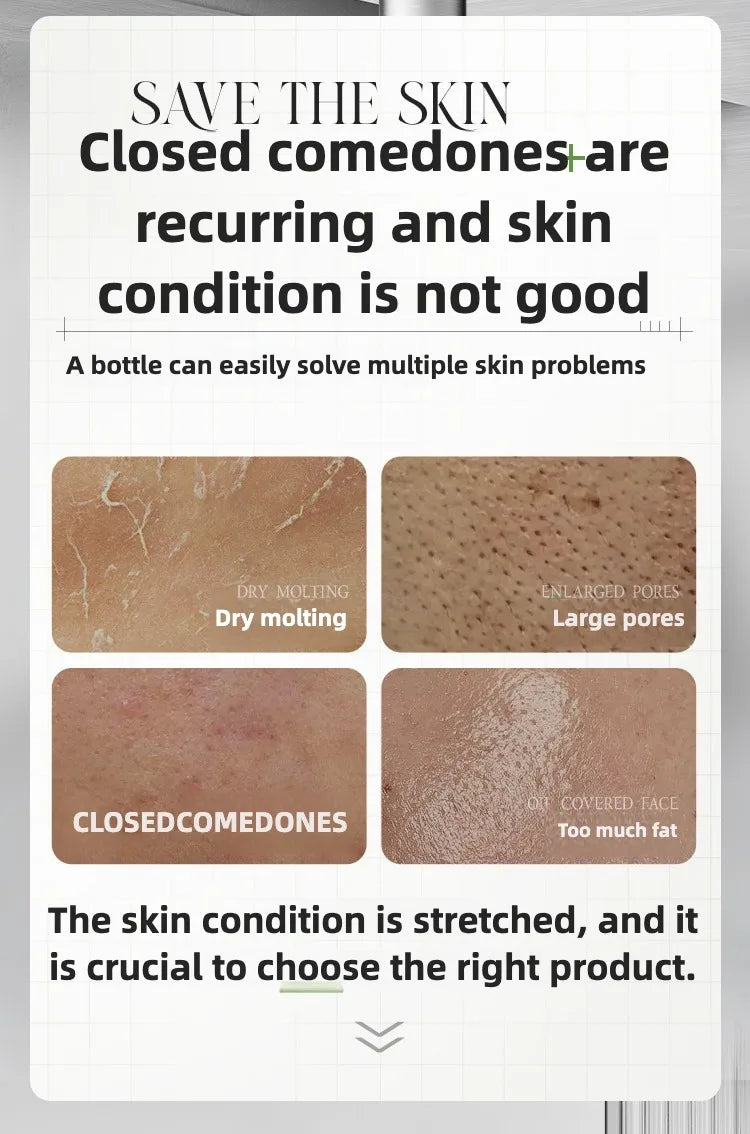 Rosemary Hydrosol essence Moisturizing Serum Fade Fine Lines Facial Moisturizing brightning Anti Aging Firming Skin Care