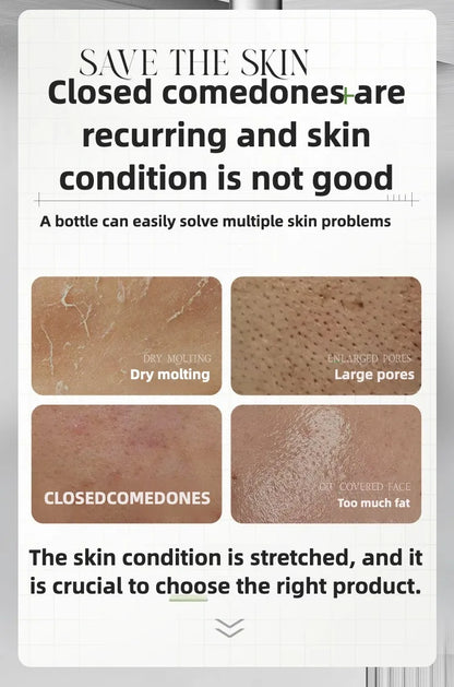 Rosemary Hydrosol essence Moisturizing Serum Fade Fine Lines Facial Moisturizing brightning Anti Aging Firming Skin Care