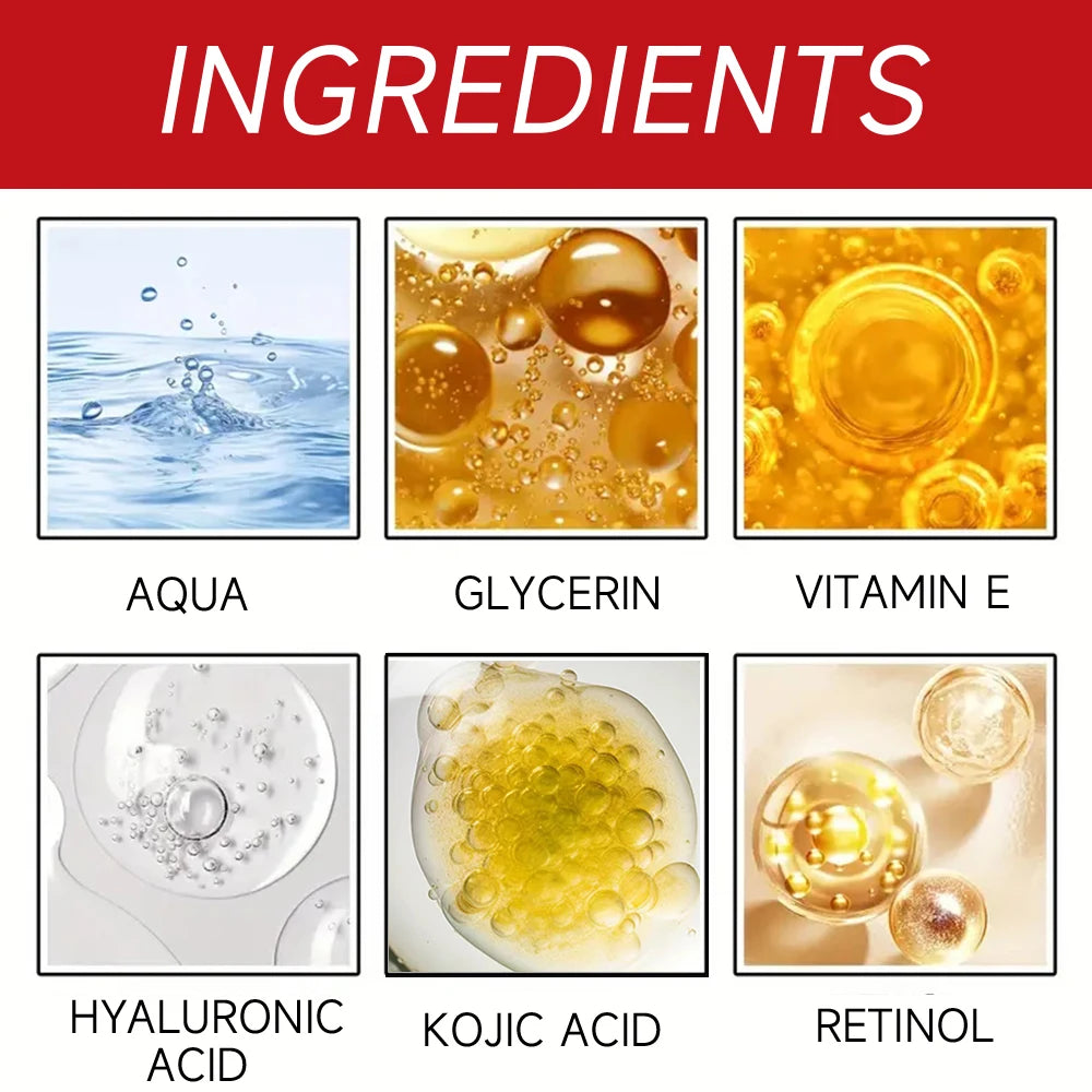 Kojic Acid & Retinol Face Cream: Gentle Hydration for Smooth, Radiant Skin – Daily Moisturizer for All Skin Types 30/60g