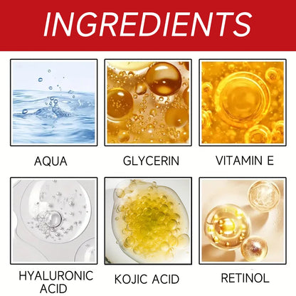 Kojic Acid & Retinol Face Cream: Gentle Hydration for Smooth, Radiant Skin – Daily Moisturizer for All Skin Types 30/60g