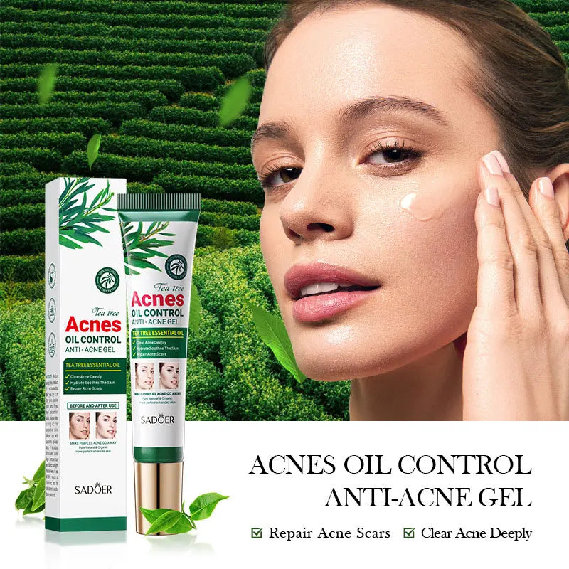SADOER Tea Tree Acne Removing Cream Facial Skincare Oil Control Face Gel Creams Hydrating Moisturizing Facial Cream Skin Care